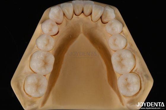 3D Multilayer Dental Full Zirconia Resistenza ai frantumi Struttura dentale naturale