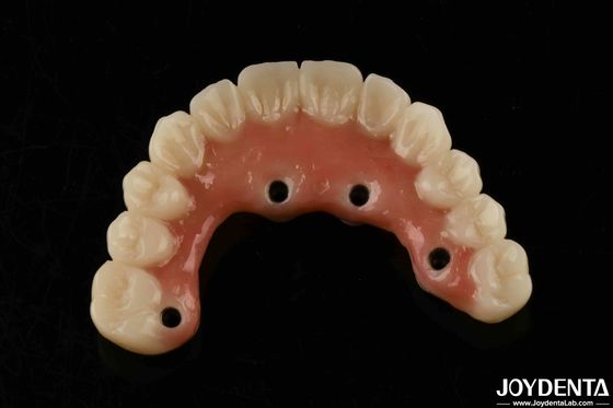Asciugatura rapida Barre di titanio denti acrilici Finitura denti acrilici chiari forniture dentali