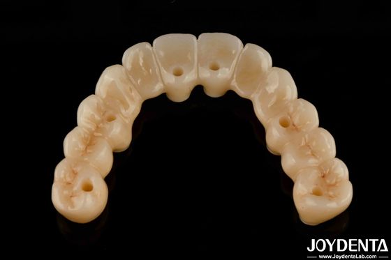 Ponte ibrida in zirconia ad alta flessibilità con base in titanio