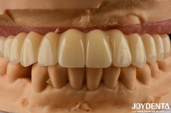 Soluzione dentale Ti-Base Zirconia Hybrid Bridge Alta biocompatibilità aspetto naturale