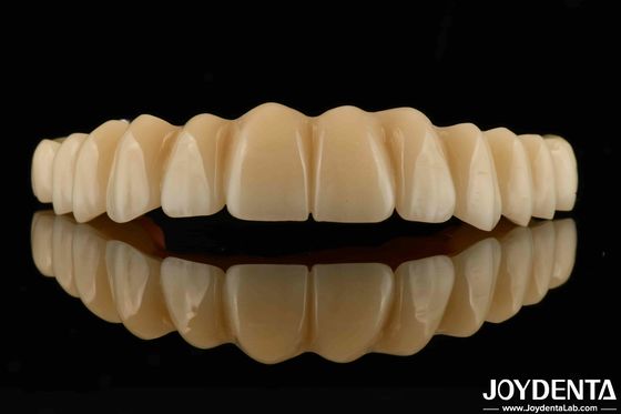 Ponte ibrida a base di titanio zirconia ad alta resistenza alla corrosione