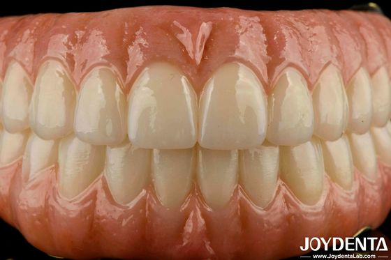 Precise Fit Dental Ti-Bar Zirconia Hybrid Bridge Replacement per i denti mancanti