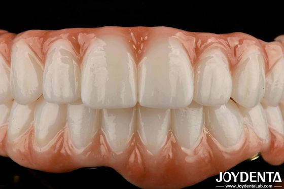 Bar di titanio di lunga durata Zirconia Hybrid Bridge Aspetto naturale Estetica per restauro