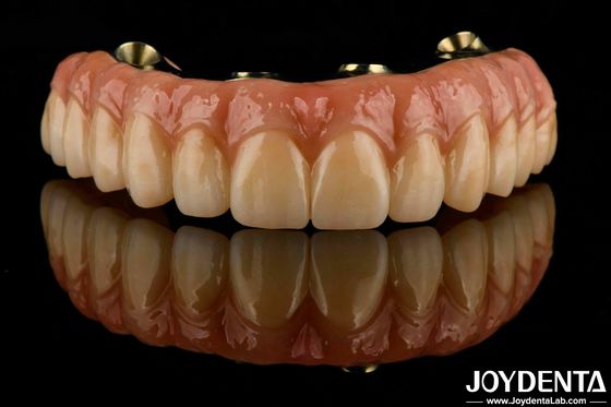 Ponte di zirconia ibrida dentaria in ti-bar eccellente resistenza ripristina la funzione masticatrice