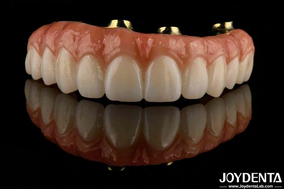 Comodo da indossare Bar di titanio Zirconia Hybrid Bridge Alta biocompatibilità Durata