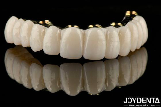 Ponte di impianto ibrido di zirconia liscia che ripristina la funzione di masticazione su misura