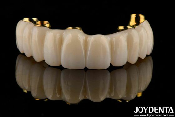 Precisione dentale Bar di titanio ibrido Zirconia Ponte personalizzazione Alta biocompatibilità