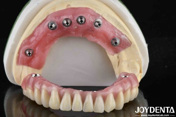 Finitura di denti in acrilico a base di Ti traslucido per la produzione di laboratori dentali