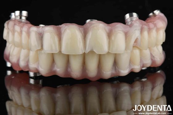 Finitura di denti in acrilico per alta resistenza all'usura
