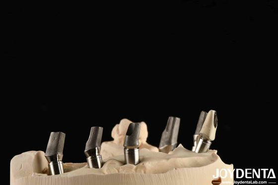 Fabbricazione su misura di titanio lucidato abutment di cemento retensione a forma di V tipo di filo