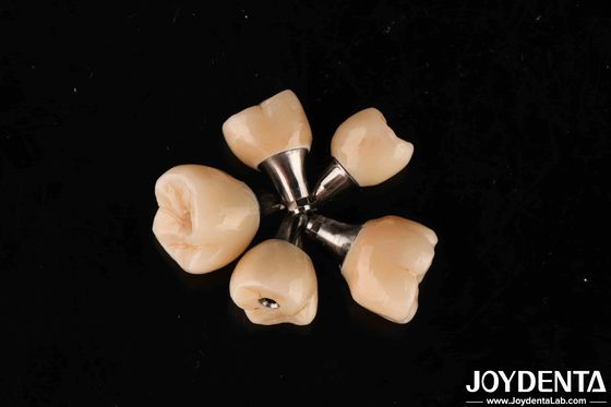 Ritenzione a vite Abutmenti in titanio Connessione esessuale interna per impianti dentali