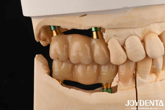 4.5mm altezza lucidato interno esatto abutments impianto dentale V forma vite trattenuto
