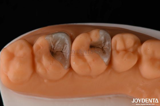 Infissi e infissi compositi per il restauro dentale