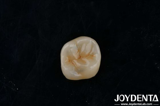 Adesivo personalizzabile Infissi in zirconia Infissi ad alta traslucidità per il restauro