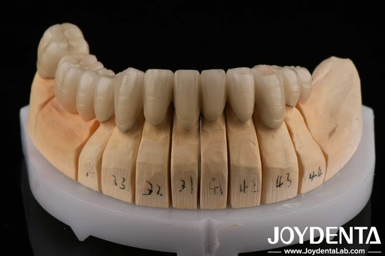 Porcellana PFM in lega d'oro fusa al metallo Dental Compatibile con strati di porcellana