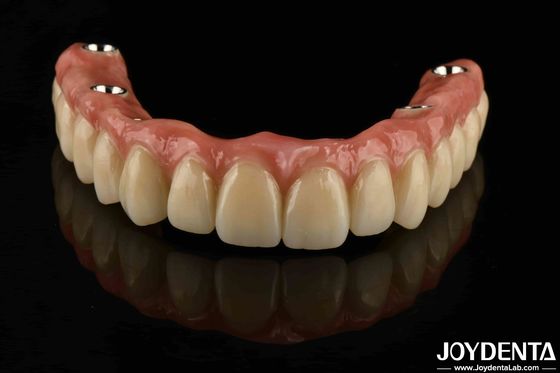 Ponte ibrida dentale in titanio personalizzato resistenza alla corrosione regolabile
