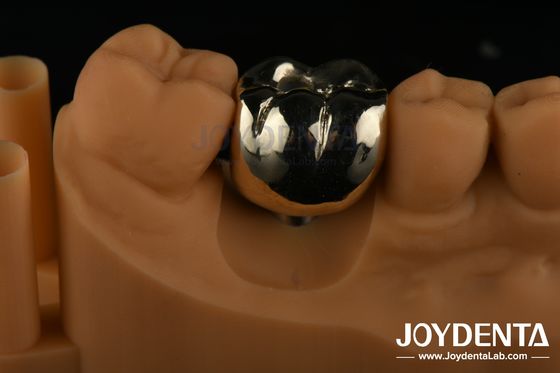 Rehabilitazione orale Fusione di cera FMC Corona di metallo per la riparazione clinica dentale