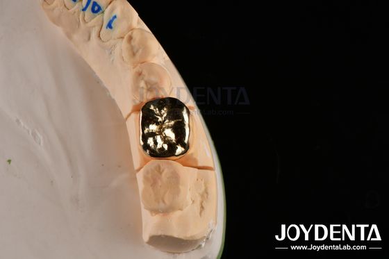 Resistenza agli abrasivi Cera dentale Fusione FMC Corona per riparazione clinica orale