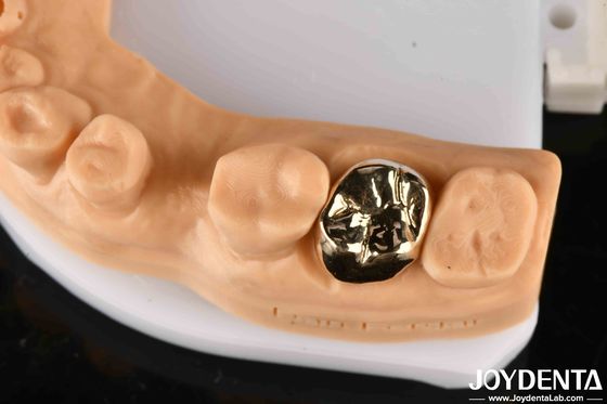 Materiale metallico corona dentale oro, corona dentale d' oro per la riabilitazione orale ottimale