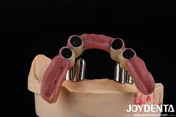 Appendici di precisione dentale supporta parti delle protesi dentali restaurazioni accurate