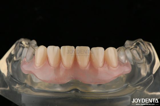 Denti invisibili personalizzate con tecnologia avanzata di arrangiamento dei denti