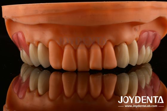 Impianto strutturale Denti di finitura Tecnologia elaborata Belle aspetto armonioso Disegno