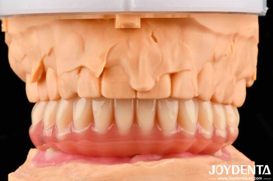 Dentiera acrilica dall'aspetto naturale, alta biocompatibilità con la tecnologia di arrangiamento dei denti