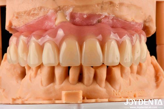 Confortevole indossare protesi dentali acriliche con tecnologia di arrangiamento dei denti