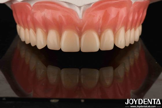 Denti Acrilici Finitura Materiale di resina leggero Restaurazioni dentali Disposizioni dentali