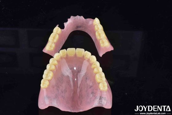 Denti finiti flessibili ad alta elasticità per personalizzazioni