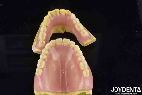 Morfologia dei denti naturali Protesi flessibile Finitura dentale per comodità e sicurezza