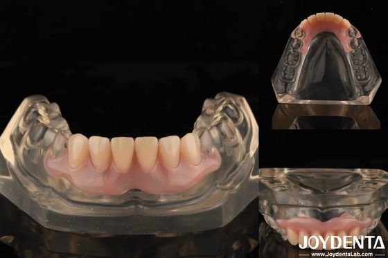 Tecnologia di arrangiamento dei denti Flessibile Finitura dentale ad alta elasticità Personalizzazione