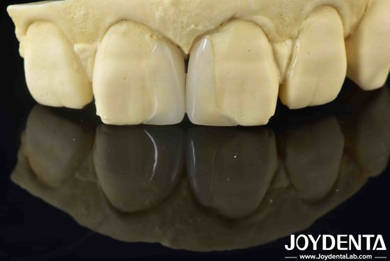 Veneer micro sottili lisci e personalizzabili Veneer naturali di lunga durata