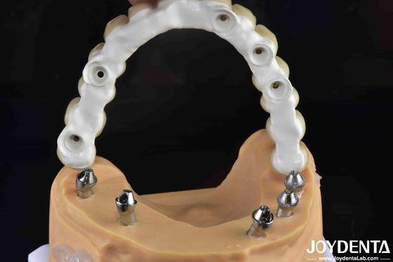 Soluzione dentale resistente alle fratture a base di zirconia ibrida ad alta resistenza