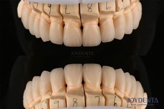 Circonia dentale stratificata lucidata spessore 0,3-0,5 mm con tecnologia CAD CAM