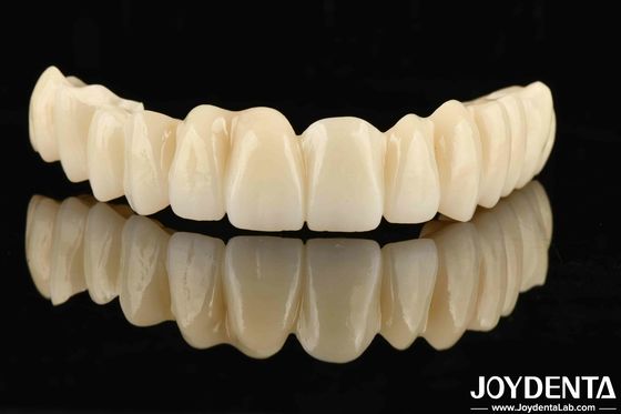 Progettazione multicapa PMMA dentale a gradiente senza cuciture per transizioni di ombra naturali
