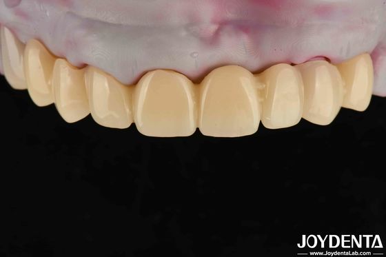 Materiale dentale PMMA ad alta trasparenza Colore naturale Estetica vivace