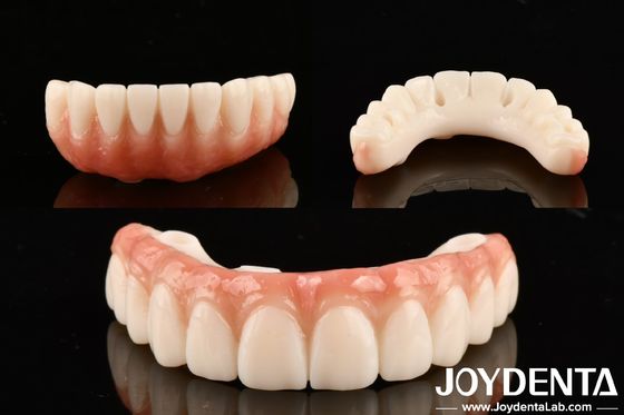 Dental PMMA M75 ad alta trasparenza per restauri estetici e resistenti agli graffi