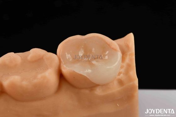 Porcellana polimerizzata Infissi e rivestimenti estetici e durevoli