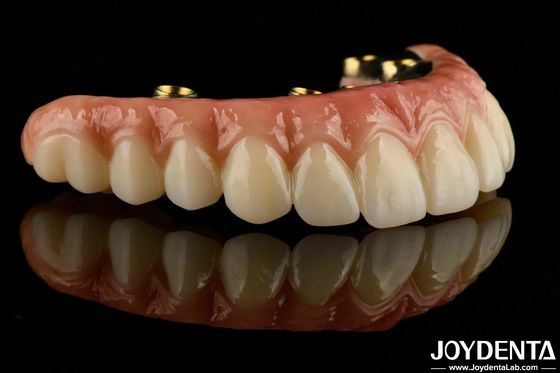 Ponte ibrida di zirconia a base di ti-bar per protesi dentali di lunga durata