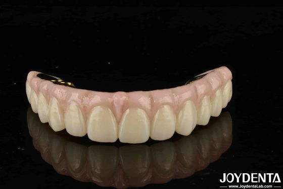 Circonia ad alta resistenza soluzione definitiva per la compatibilità di denti e gengive naturali