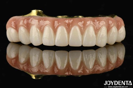 Titanio e Zirconia Comfort Comodo da indossare Ti-Bar Zirconia Hybrid Bridge per la sostituzione di denti mancanti