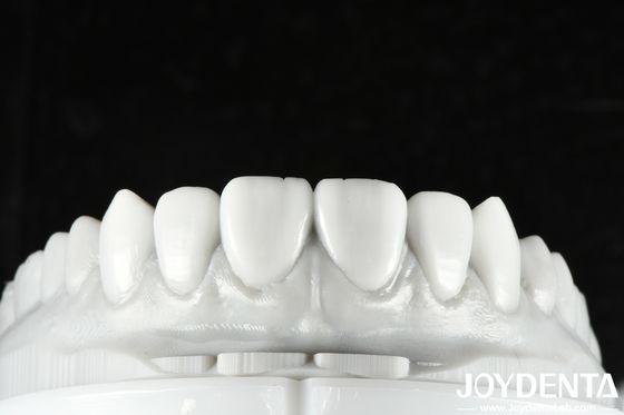 Cerume dentale a colori naturali Soluzione versatile per il restauro di denti singoli o multipli