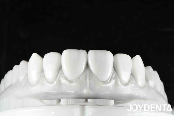 Finitura flessibile della protesi rivoluzionate il vostro studio dentale con la morfologia naturale dei denti tecnologia di arrangiamento dei denti e proprietà leggera