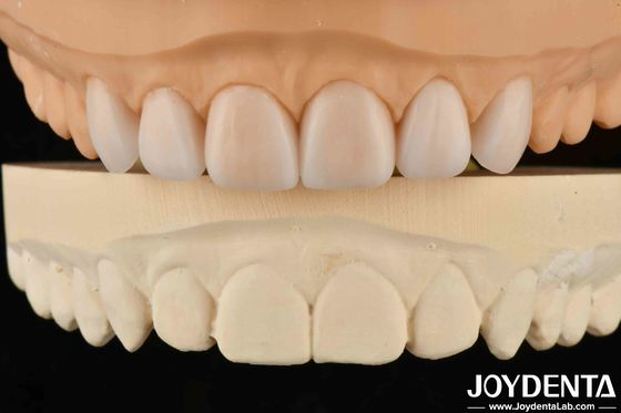 Leggera proprietà protesi flessibili finitura personalizzata per diverse specifiche