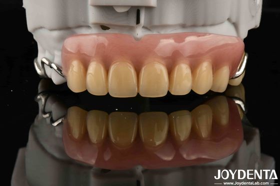 Elaborare un quadro di struttura orale stabile per i denti e creare una finitura per la salute orale ottimale