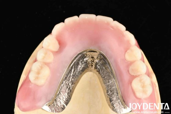 Fermamente collegare file di denti elaborare il quadro tecnologico impostare denti finitura per i professionisti dentali e risultati accurati