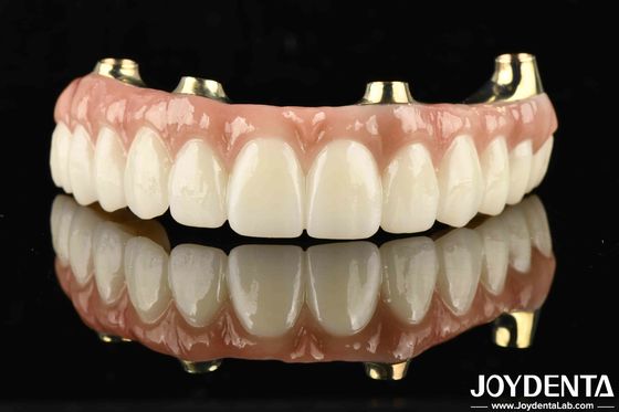 Funzionalità Ti-Bar compatibile con denti e gengive naturali ripristina la funzione di masticazione