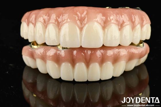Ponte ibrido in zirconia in Ti-Bar ad alta resistenza per ottenere un aspetto estetico