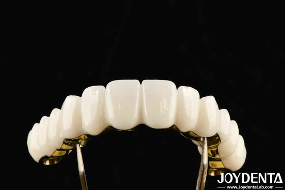 Circonia su misura Ottima resistenza per soluzioni dentali personalizzate